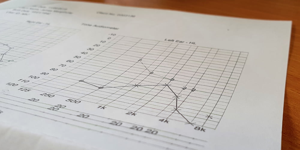 Side photo of an audiogram