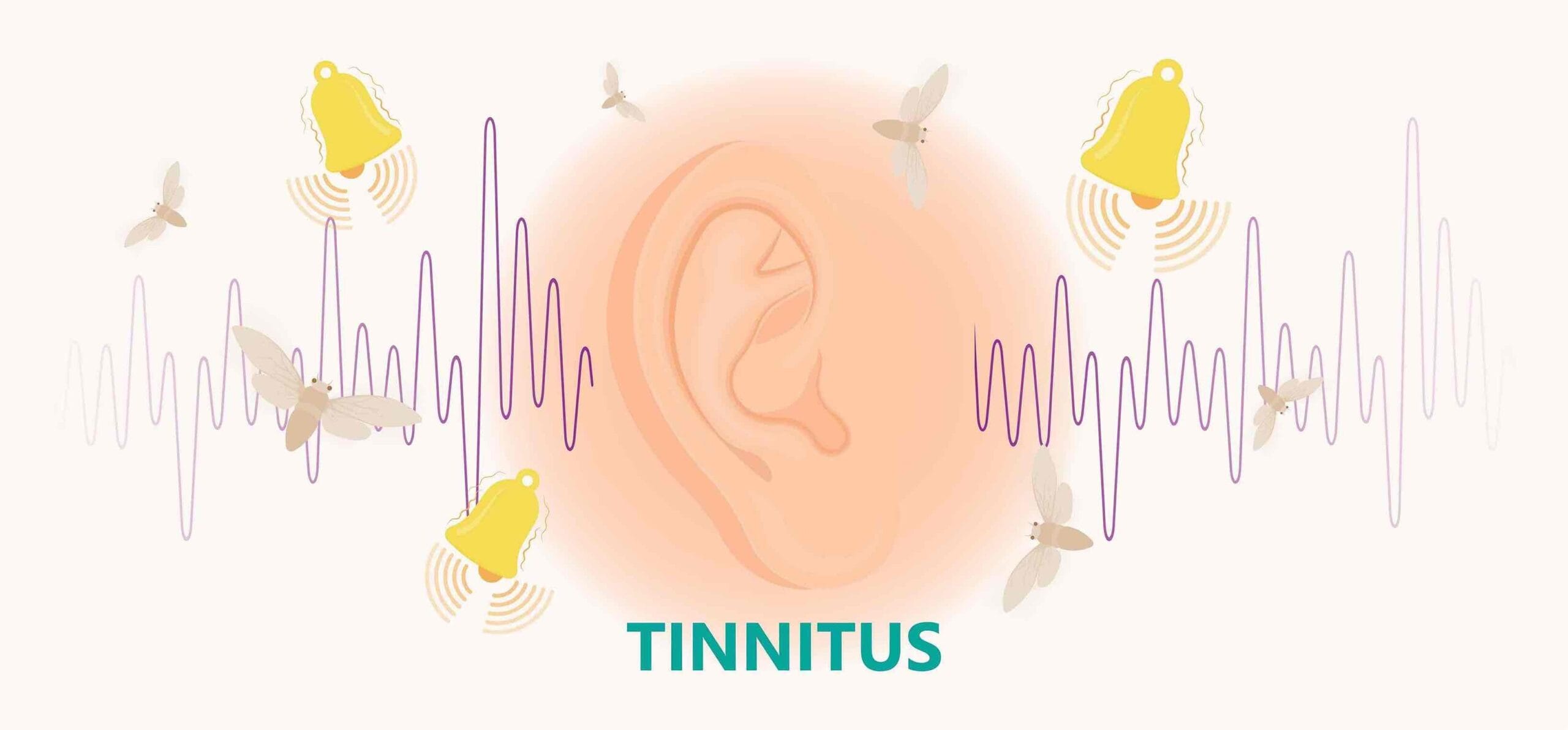 Read more about the article Tinnitus Explained: Causes, Symptoms, and Tinnitus Treatment